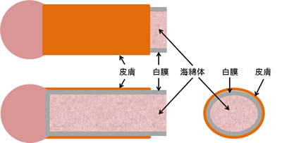 屈曲・湾曲ペニスのイメージイラスト3