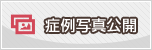 実例写真公開