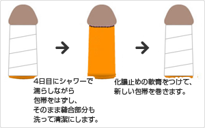 包帯の交換について