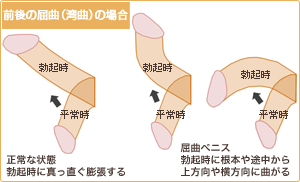 前後の屈曲・湾曲